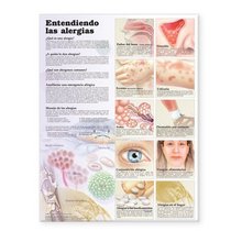 Understanding Allergies Anatomical Chart in Spanish (Entendiendo Las Alergias) (Spanish Edition)