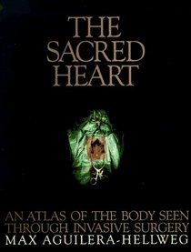 The Sacred Heart: An Atlas of the Body Seen Through Invasive Surgery