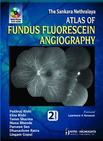 The Sankara Nethralaya Atlas of Fundus Fluorescein Angiography