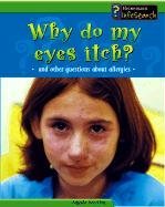Why Do My Eyes Itch?: And Other Questions About Allergies (Body Matters)
