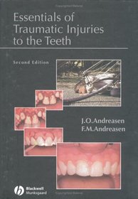 Essentials of Traumatic Injuries to the Teeth: A  Step-by-Step Treatment Guide