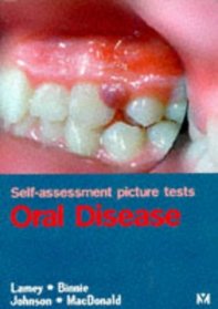 Self-Assessment Picture Tests: Oral Disease