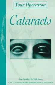 Cataracts (Your Operation S.)