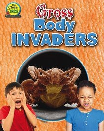 Gross Body Invaders (Up Close and Gross: Microscopic Creatures)