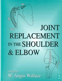 Joint Replacement in the Shoulder and Elbow