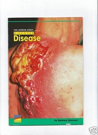 The Human Body Discover Disease