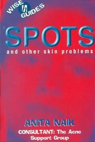Spots (Wise Guides)