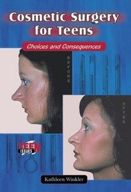 Cosmetic Surgery for Teens: Choices and Consequences (Teen Issues)