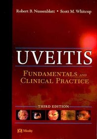 Uveitis: Fundamentals and Clinical Practice