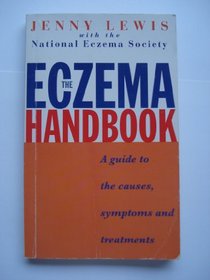 THE ECZEMA HANDBOOK: A GUIDE TO THE CAUSES, SYMPTOMS AND TREATMENTS