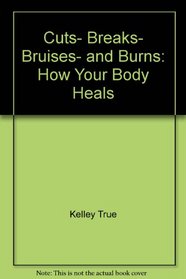 Cuts, breaks, bruises, and burns: How your body heals