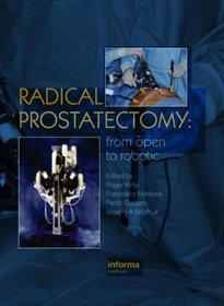 Radical Prostatectomy: Principles and Practice