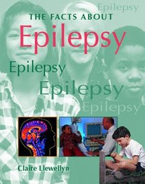 Epilepsy (Facts About)