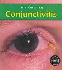 Conjunctivitis (Its Catching)