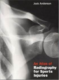 An Atlas of Radiography for Sports Injuries
