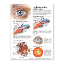 Understanding Glaucoma Anatomical Chart