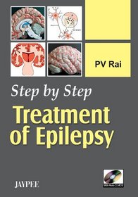 Step by Step Treatment of Epilepsy with Photo CD-ROM