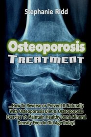 Osteoporosis Treatment: How To Reverse or Prevent It Naturally With Osteoporosis Diet And Osteoporosis Exercise To Maintain Healthy Bone Mineral Density Even In Old Age Today!