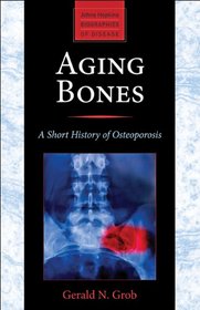 Aging Bones: A Short History of Osteoporosis (Johns Hopkins Biographies of Disease)