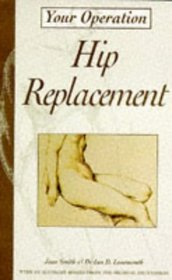 Hip Replacement (Your Operation S.)