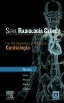 Serie Radiologia Clinica. Los 100 Diagnosticos Principales En Cardiologia (Spanish Edition)