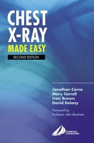 Chest X-Ray Made Easy (Made Easy Series)