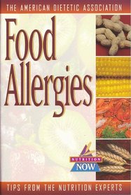 Food Allergies (Nutrition Now Series)