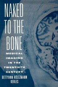 Naked to the Bone: Medical Imaging in the Twentieth Century (Sloan Technology Series)