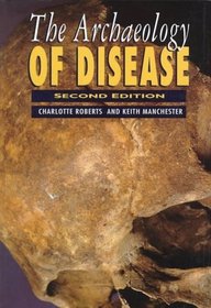 The Archaeology of Disease