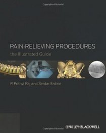 Pain-Relieving Procedures: The Illustrated Guide