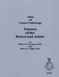 Tumors of Bones and Joints (Atlas of Tumor Pathology 3rd Series)