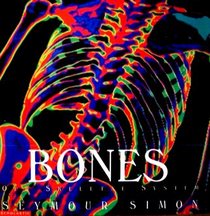 Bones