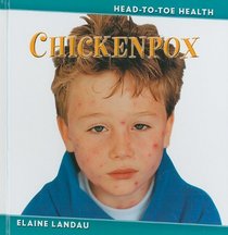 Chickenpox (Head-to-Toe Health)