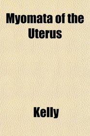 Myomata of the Uterus