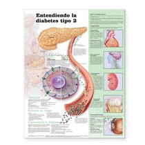 Understanding Type 2 Diabetes Anatomical Chart in Spanish (Comprendiendo la diabetes tipo 2) (Spanish Edition)