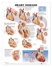 Heart Disease Anatomical Chart