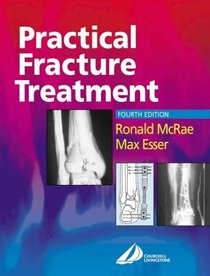 Practical Fracture Treatment, 4E