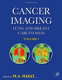 Cancer Imaging, Volume 1: Lung and Breast Carcinomas