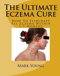 The Ultimate Eczema Cure: How To Eliminate All Eczema Within 1-3 Months