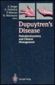 Dupuytren's Disease: Pathobiochemistry and Clinical Management