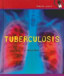 Tuberculosis (Health Alert)