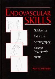 Endovascular Skills: Guidewires, Catheters, Arteriography, Balloon Angioplasty, Stents