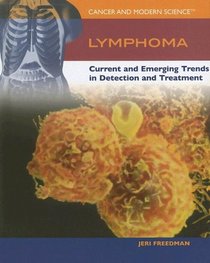 Lymphoma: Current And Emerging Trends in Detection And Treatment (Cancer and Modern Science)