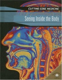 Seeing Inside the Body (Cutting Edge Medicine)