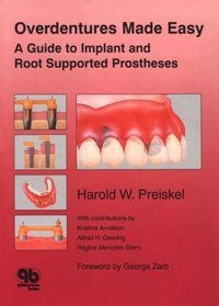 Overdentures Made Easy: A Guide to Implant and Root Supported Prostheses