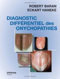 Nail in Differential Diagnosis (Pharma French Edition)