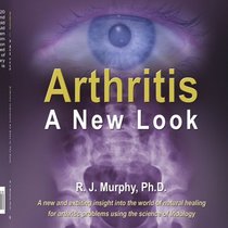 Arthritis-A New Look: Arthritic Indicators As Seen In The Eyes