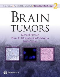 Brain Tumors (Consultant Pathology)