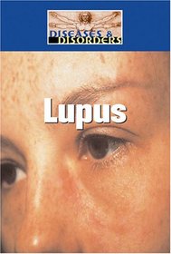 Lupus (Diseases and Disorders)