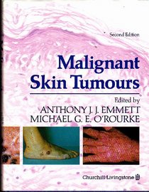 Malignant Skin Tumours